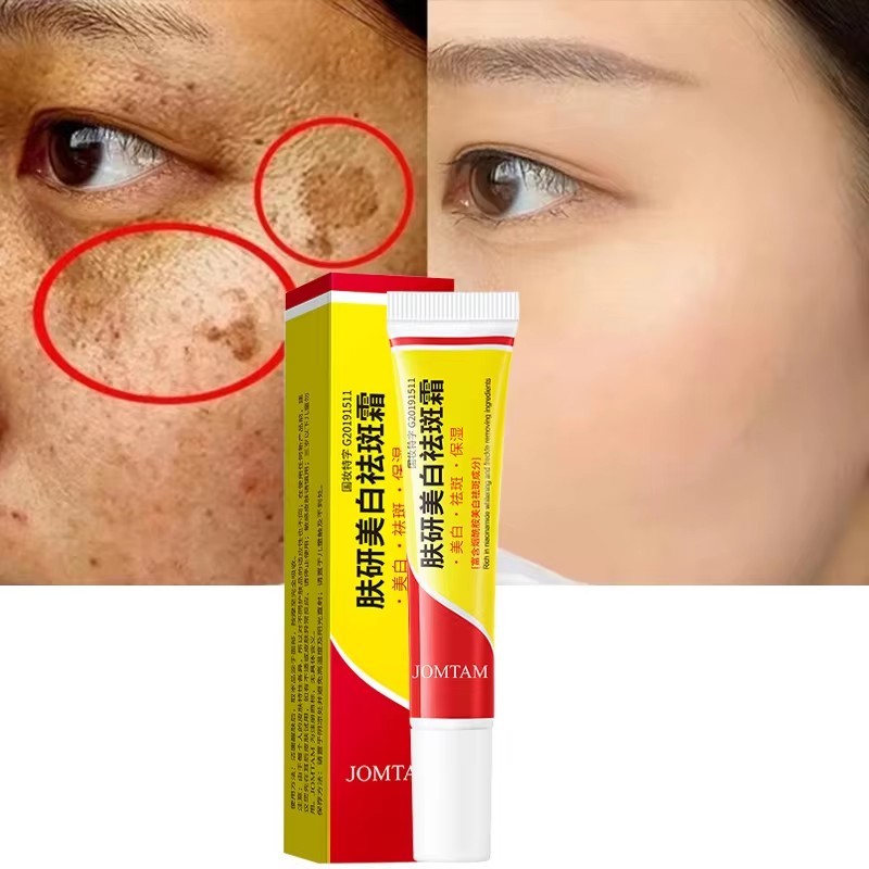 Skincare Glad2Glow - 화이트닝 주근깨 크림 페이스 브라이트닝 크림