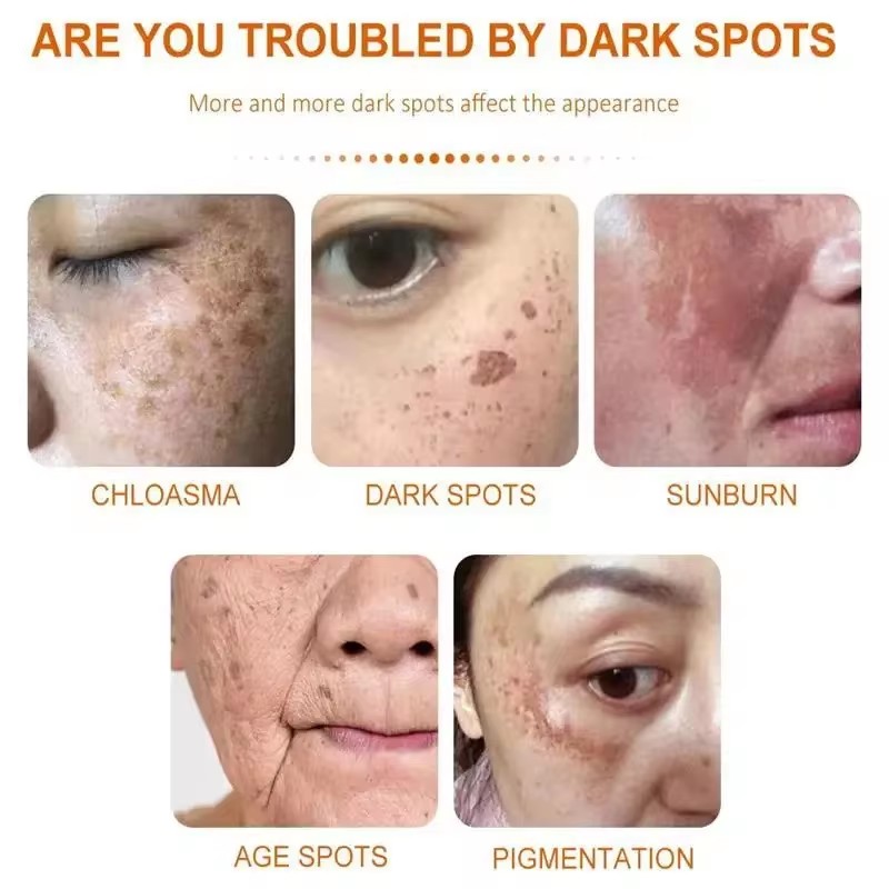 화이트닝 주근깨 크림 페이스 브라이트닝 크림 나이아신아 - Skincare Glad2Glow 리뷰 및 가격