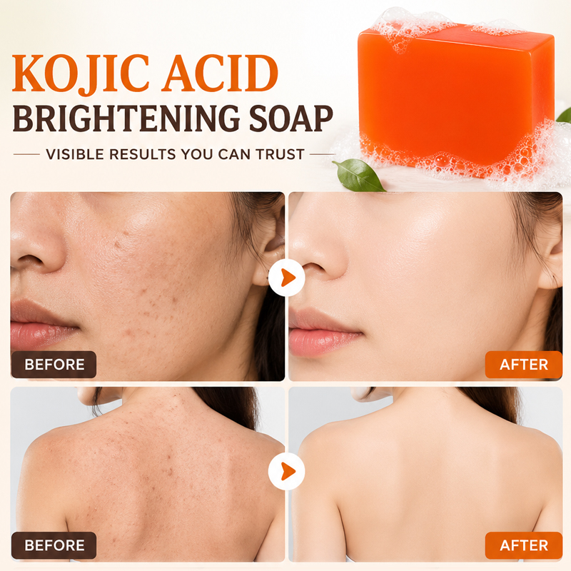 코직산 비누 6개입, 미백 및 딥 클렌징, 피부 정화, - Kojic Acid Soap 리뷰 및 가격