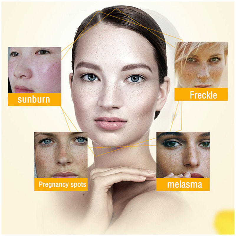 Dimollaure-미백 주근깨 보습 크림, 퍼밍, 주 - Skincare Herbal 리뷰 및 가격